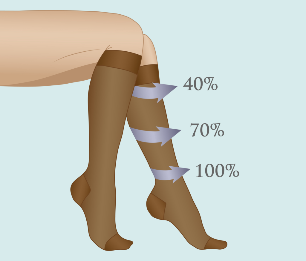 Understanding Graduated Compression Socks Benefits, Uses, and